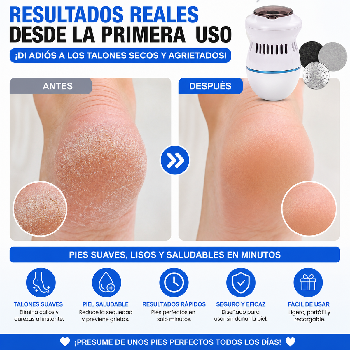 ✨ Lima electrica para pies-¡Adiós a los Talones Secos!