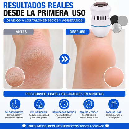 ✨ Lima electrica para pies-¡Adiós a los Talones Secos!